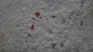 Resident of Ejmiatsin Arrested on Suspicion of Stabbing Fellow-Citizen (photos)