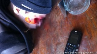 Վագոն-տնակում հայտնաբերվել է 40-ամյա տղամարդու դի (Լուսանկարներ)