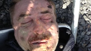 Գերեզմանատանը հայտնաբերվել է ինքնությունը չպարզված տղամարդու դի. ովքեր ճանաչում են լուսանկարում պատկերված տղամարդուն, խնդրում ենք դիմել քննչական բաժին (Լուսանկարներ)