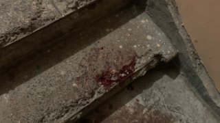 Shots in Yerevan; Criminal Case Initiated (photos)