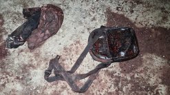 Սպանության փորձ՝ գերեզմանատանը. հարուցվել է քրեական գործ (լուսանկարներ)