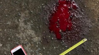 Arrested on Suspicion of his Nephew’s Murder