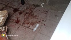 Shot in Yerevan; Criminal Case Initiated (video, photos)