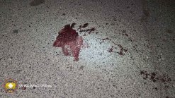 Stabbing in Malatia-Sebastia administrative district (photos)